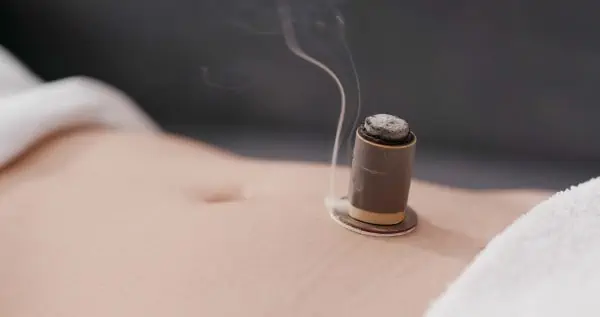 Moxa cone burning on abdomen of women having acupuncture treatment