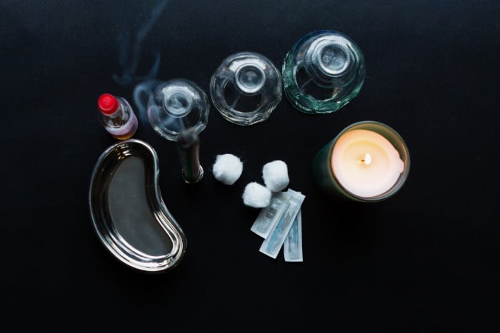 Cups and needles and other equipment for acupuncture treatment